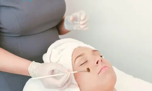 Best Spa Breaks Kilkenny - Woman Receiving a Facial at Pembroke